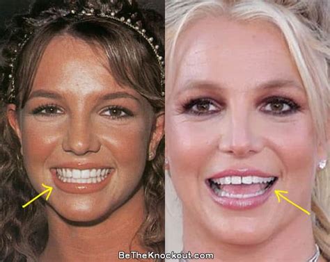 britney spears gap teeth